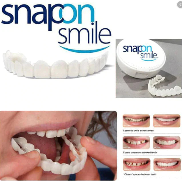 New Snap on smile